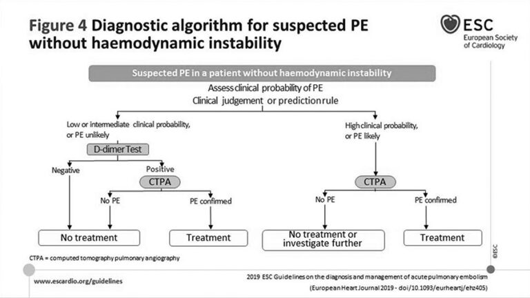 ESC Guidelines on Acute Pulmonary Embolism 2019