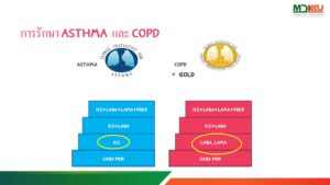 Asthma and COPD; similarities and differences | CIMjournal