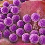 banner เชื้อโรคทั่วไป 4