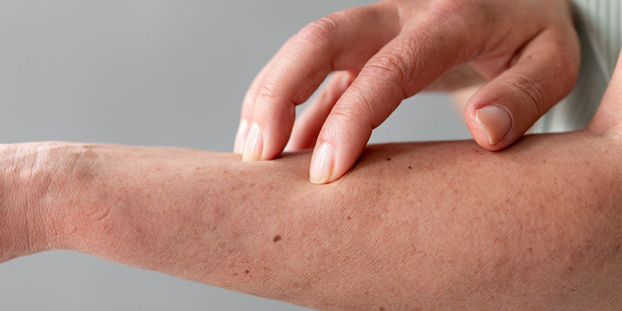 banner คันผิวหนัง 4