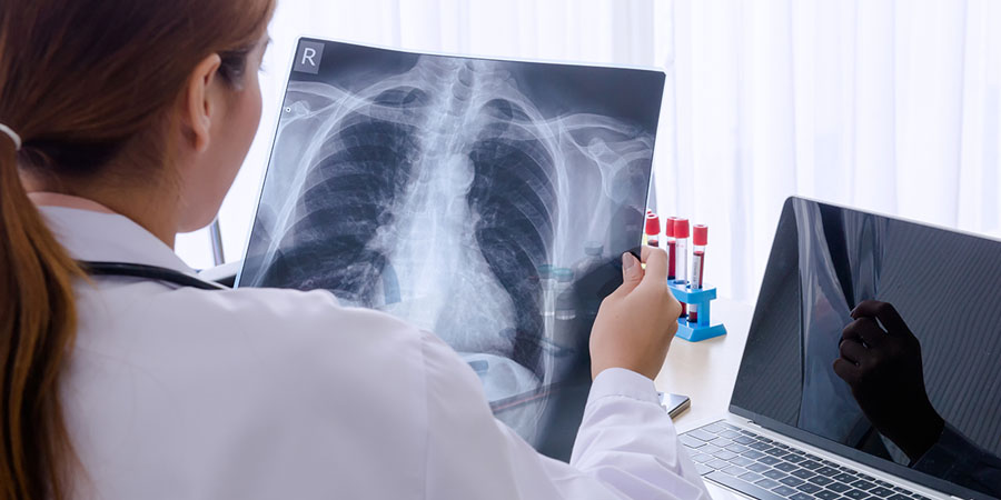 banner ปอดผิดปกติ 2