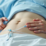 banner kidney dialysis